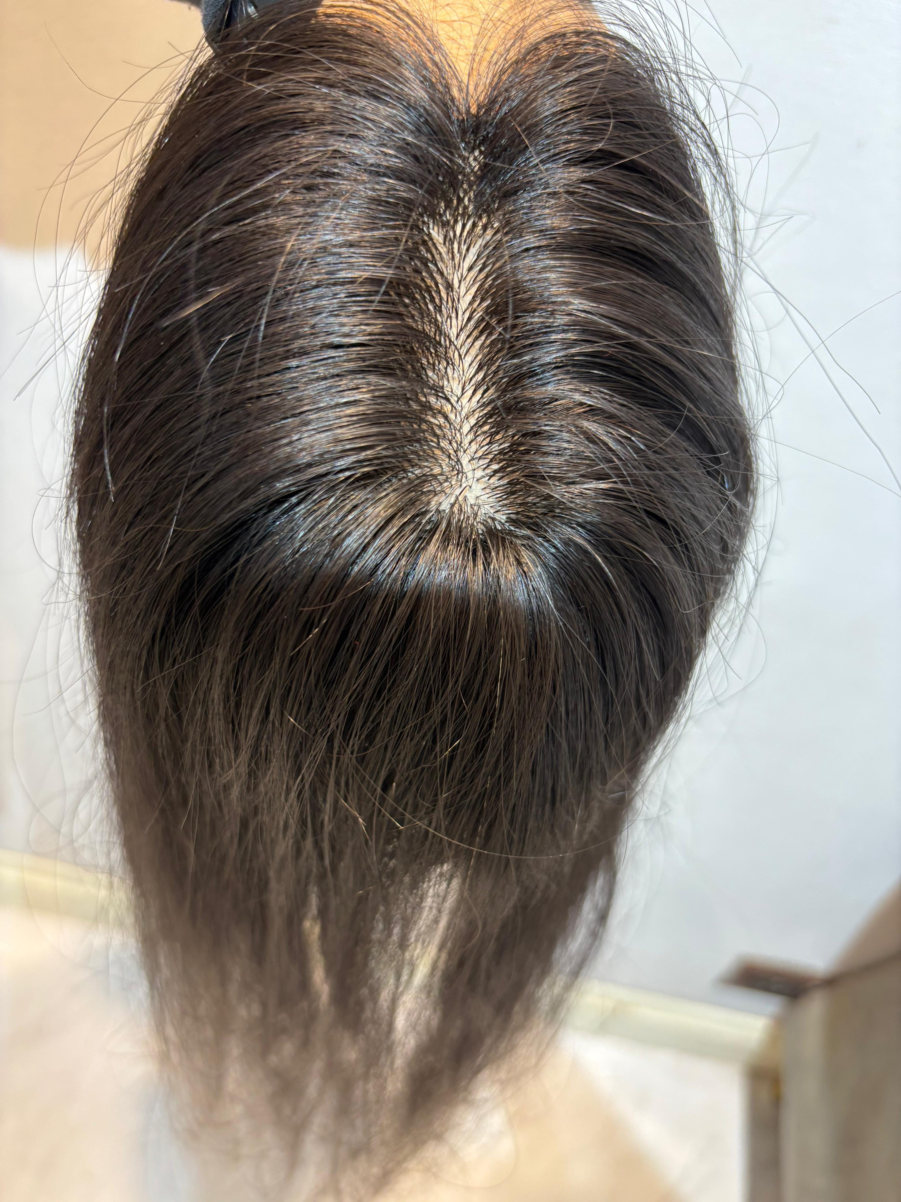 Hair Topper for Alopecia & Full Coverage | Silk Base | Natural Black | Straight | Remy Hair India